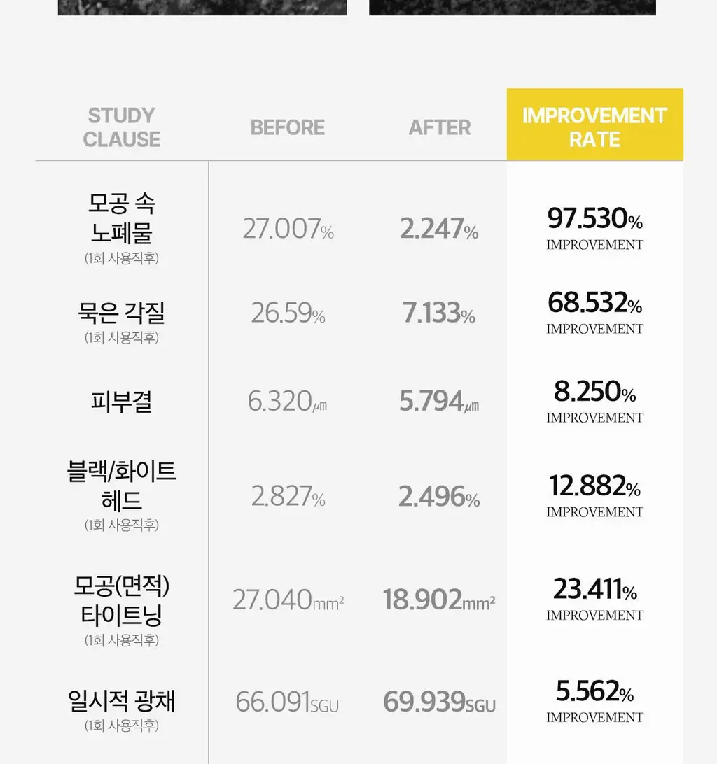 [블랙헤드/피지] 에이프릴스킨 리얼 카렌둘라 필 오프 팩 100g 상세페이지 31